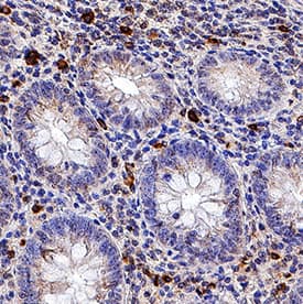 hIL-6 MAb (Cl 1936) (25 ug)
