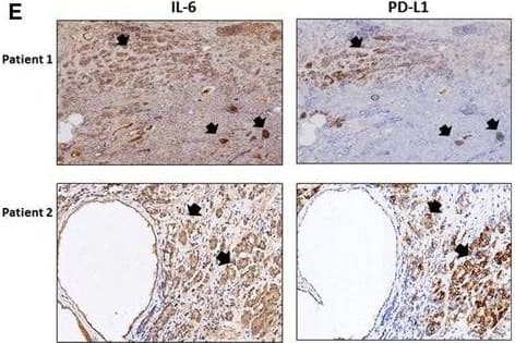 h/prIL-6 MAb (Cl 670 (25 ug)