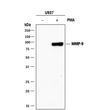 hMMP-9 MAb (Cl 4H3) (200 ug)