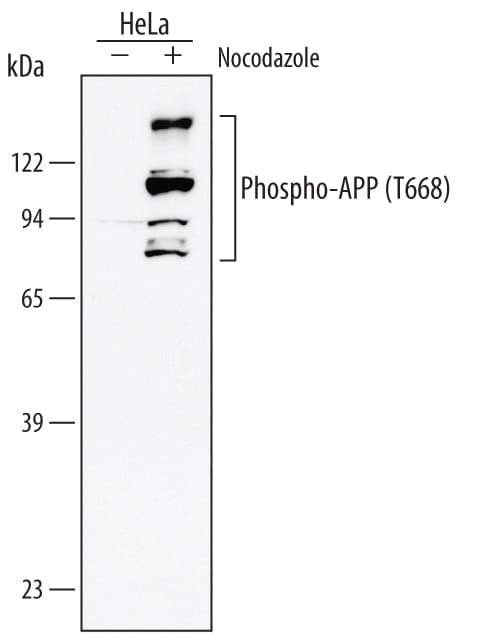 h/mPhos APP MAb (Cl (25 ug)