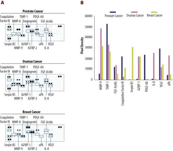 hAngiogenesis Array (1 Kit)