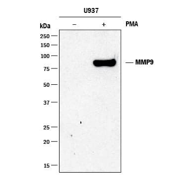 hMMP-9 MAb (Cl 4H3R) (25 UG)