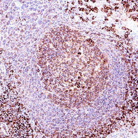hCD38 MAb (Cl 240726 (25 ug)