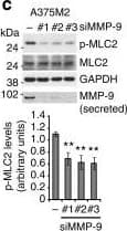 hMMP-9 MAb (Cl 4H3) (200 ug)