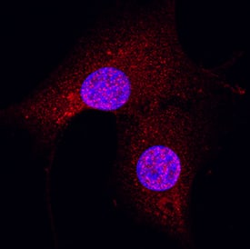 hGSK-3a/b MAb (Cl 83 (25 ug)