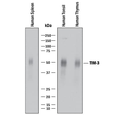 hTIM-3 MAb (Cl  2321 (25 UG)