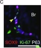 hSOX9 Aff Pur PAb (25 ug)