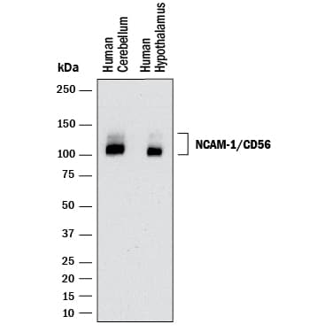 hNCAM-1 MAb (Cl 3010 (25 ug)