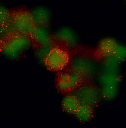hCCR7 MAb (Cl 150503 (25 ug)