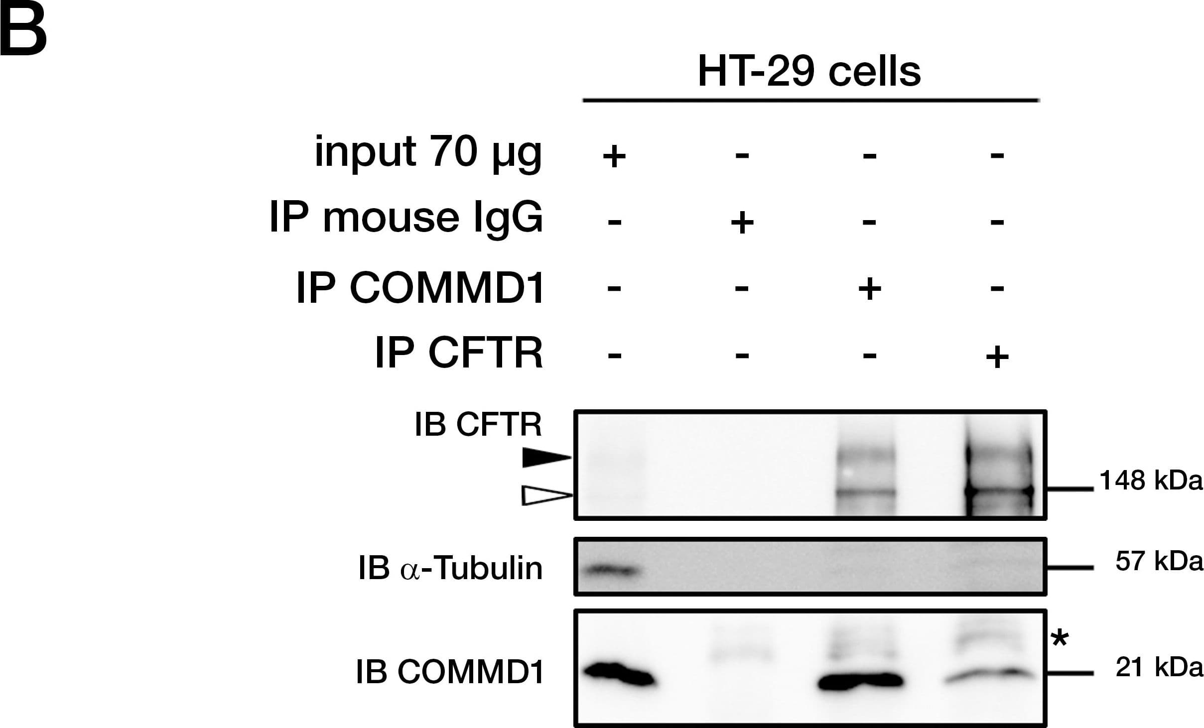 hCFTR C-term MAb (Cl (25 ug)