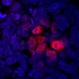 hBrachyury MAb (Cl 1 (25 ug)