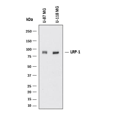 hLRP-1 CII MAb (25 ug)