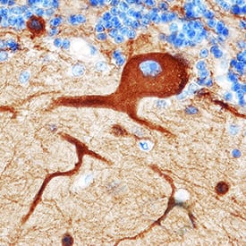 b-III Tubulin MAb (C (100 ug)