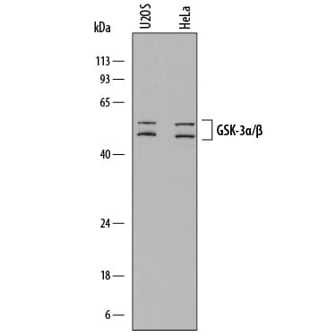 hGSK-3a/b MAb (Cl 83 (25 ug)