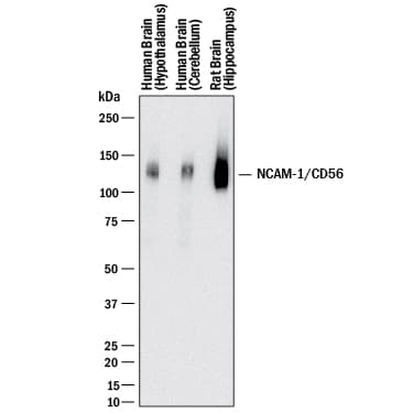 h/rNCAM-1 MAb (Cl 25 (25 UG)