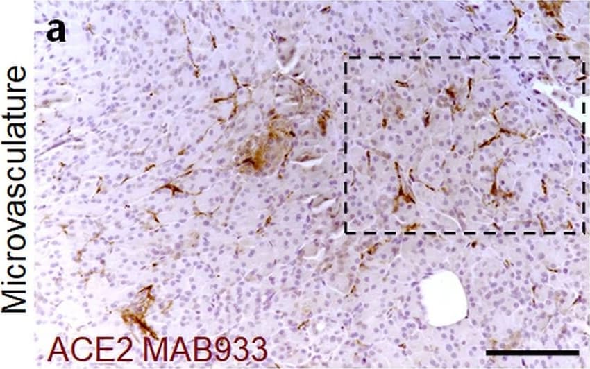 Human/Hamster ACE-2 Antibody