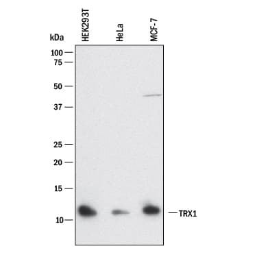 hTrx-1 MAb (Cl 76362 (25 UG)