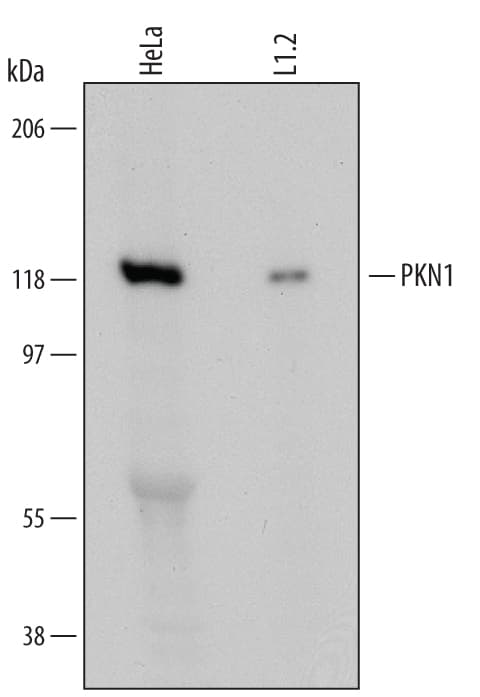 h/mPKN1 MAb (Cl 5404 (25 ug)