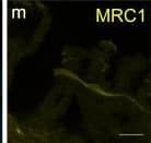 mMMR Aff Pur PAb (25 ug)