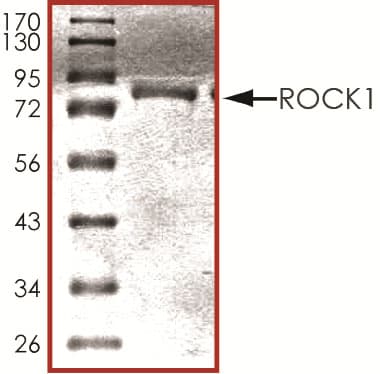 rhActive ROCK1, CF (10 ug)