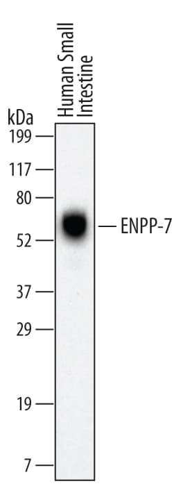 hENPP-7 MAb (Cl 5605 (25 ug)
