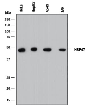 hHSP47  MAb (Cl 9508 (25 ug)