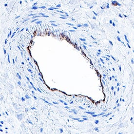 hCD31/PECAM-1 Aff Pu (25 ug)