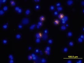 hTNF-a MAb (Cl 28401 (25 ug)