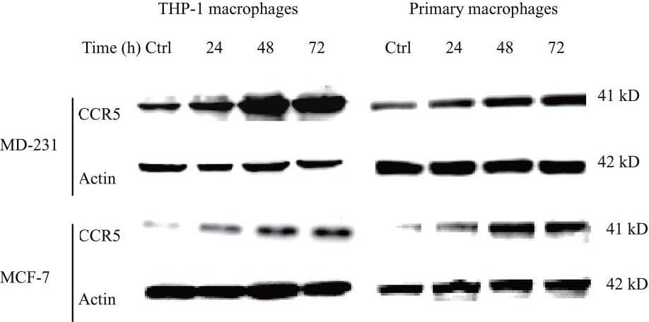 hCCR5 MAb (Cl 45523) (100 ug)