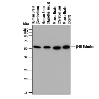b-III Tubulin MAb (C (100 ug)