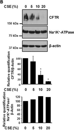 hCFTR C-term MAb (Cl (25 ug)