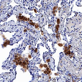 hCCR7 MAb (Cl 150503 (25 ug)