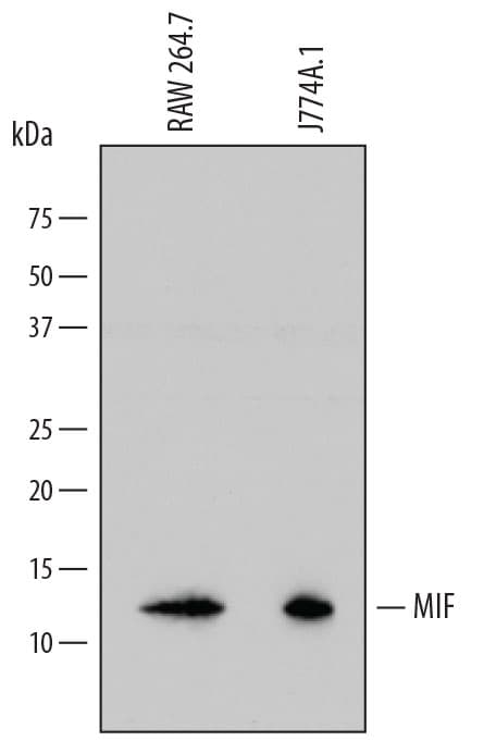 m/rMIF MAb (Cl 81142 (25 ug)