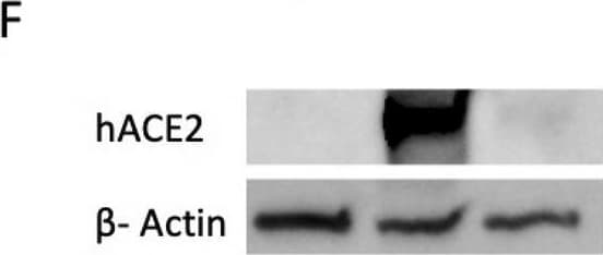 Human/Mouse/Rat/Hamster ACE-2 Antibody