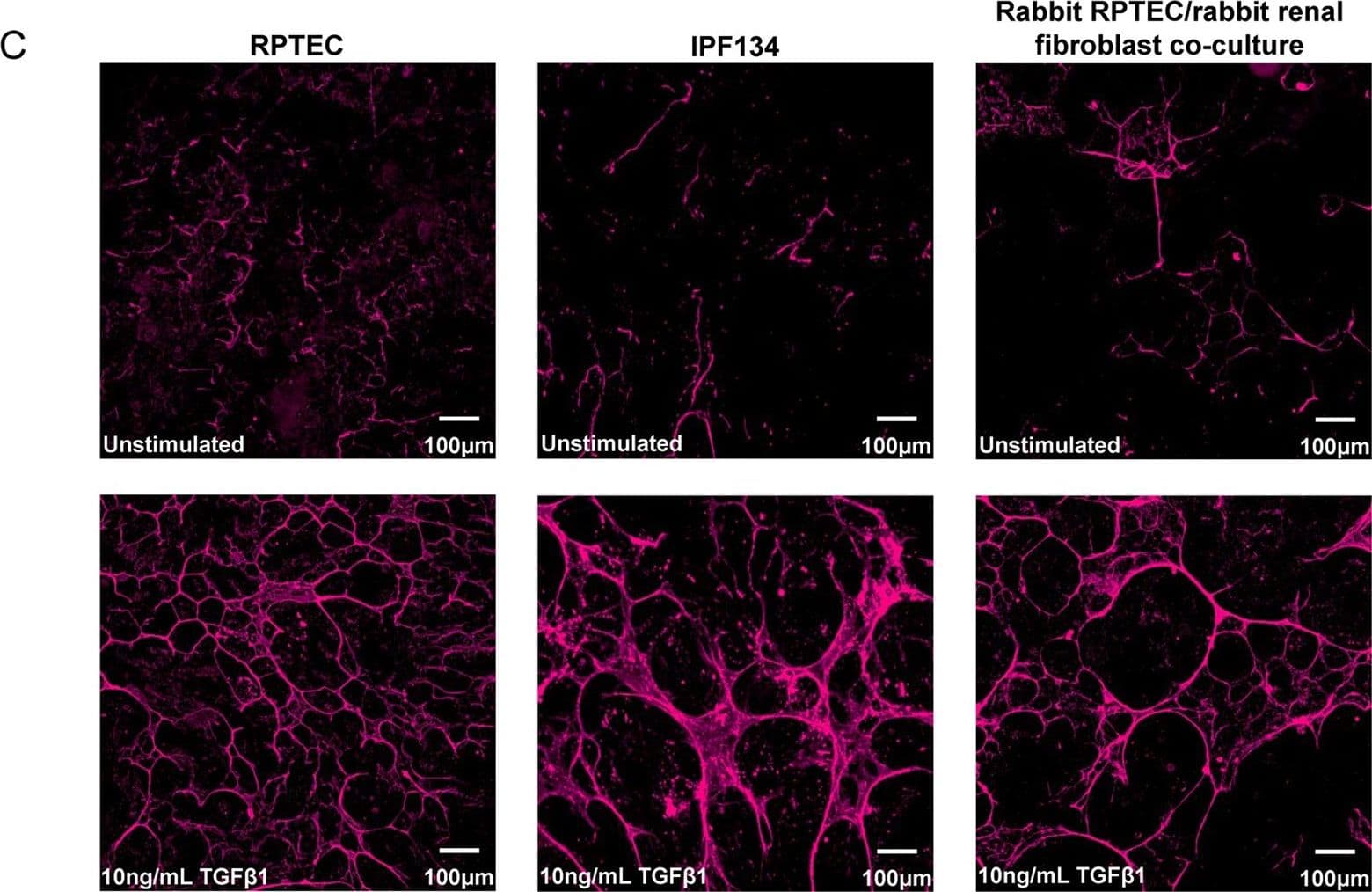 TGF-b1,2,3 MAb (Cl 1 (25 ug)
