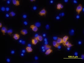 hIL-1b MAb (Cl 8516) (25 ug)