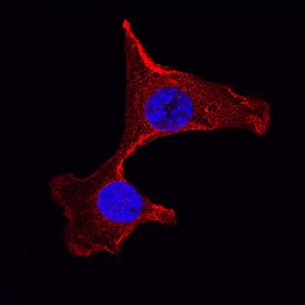 h/m/rGSK-3b MAb (Cl (25 ug)