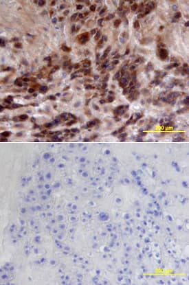 hCFTR C-term MAb (Cl (25 ug)