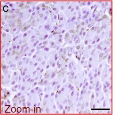 Human/Hamster ACE-2 Antibody