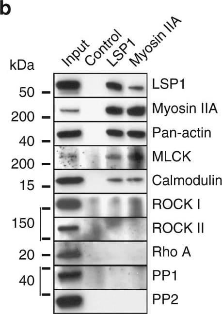 hPP1a MAb (Cl 490314 (25 ug)
