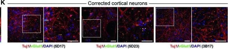 b-III Tubulin MAb (C (100 ug)