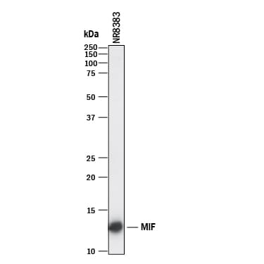 m/rMIF MAb (Cl 81142 (25 ug)