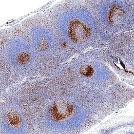 hTIM-3 MAb (Cl  2321 (25 UG)