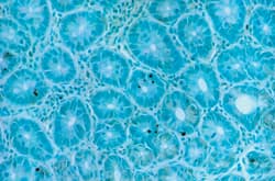 TumorTACS In Situ Ap (30 Tests)