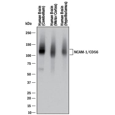 R&D Systems_Human NCAM-1/CD56 Antibody_优宁维(univ)商城