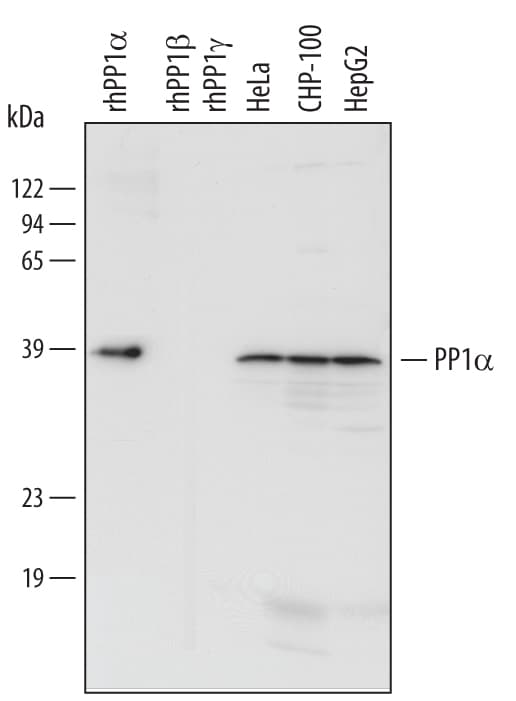 hPP1a MAb (Cl 490314 (25 ug)