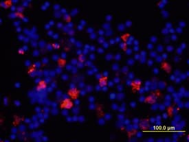 hIL-8 MAb (Cl 6217) (25 ug)