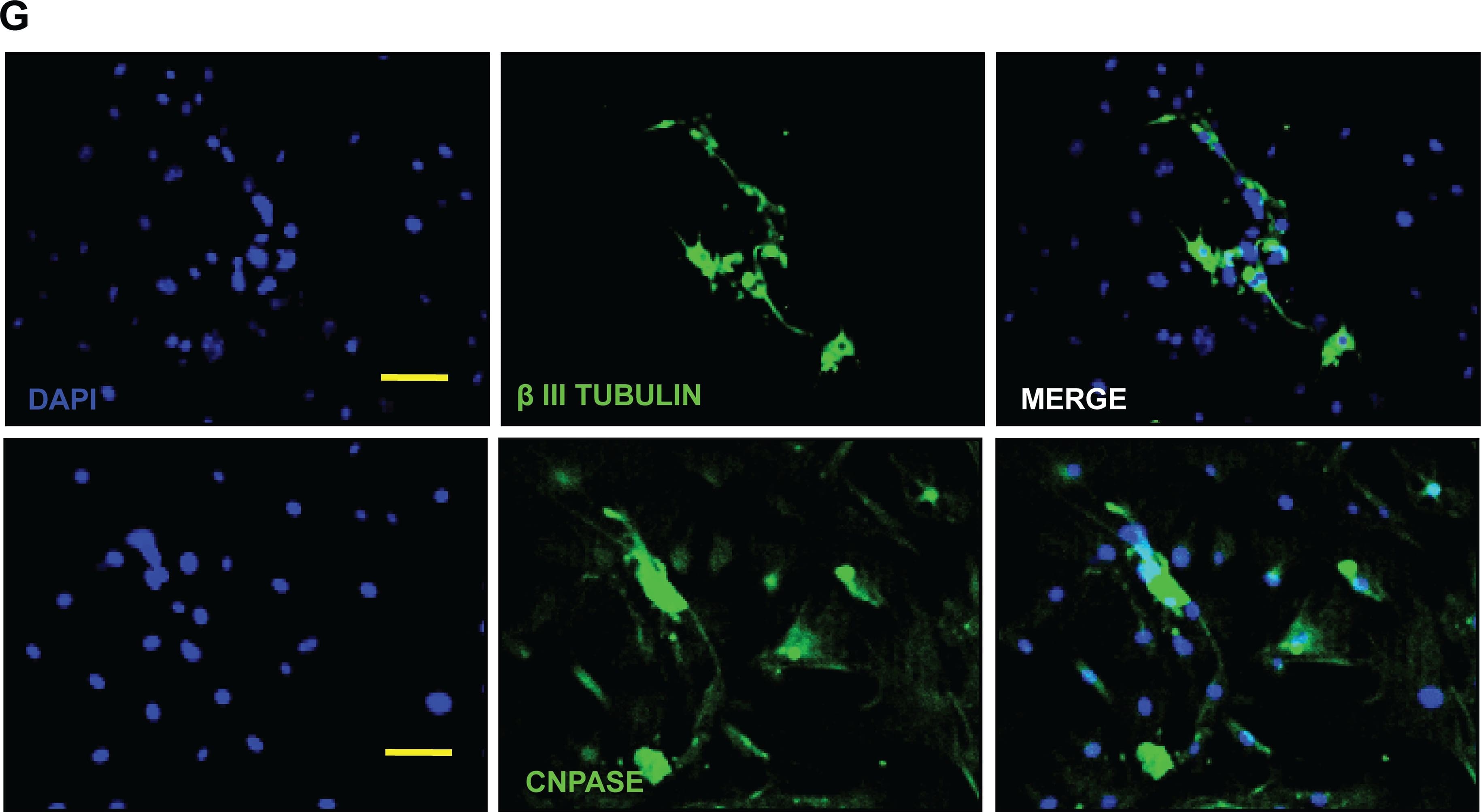 b-III Tubulin MAb (C (100 ug)