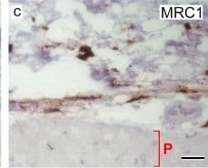 mMMR Aff Pur PAb (25 ug)