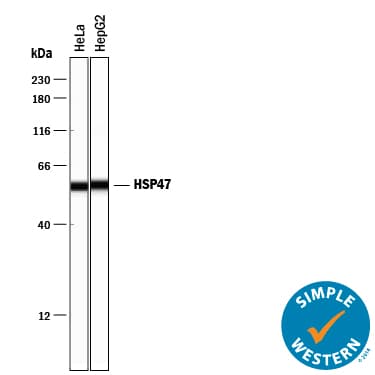 hHSP47  MAb (Cl 9508 (25 ug)